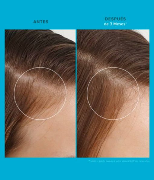 Scalp Care Revitalizing Treatment - Imagen 7