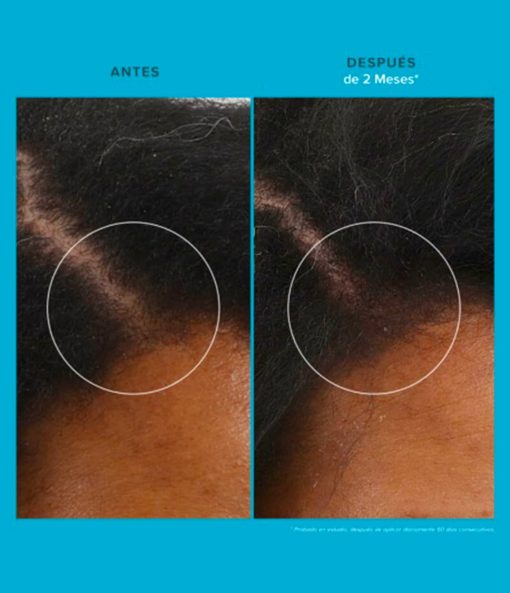 Scalp Care Revitalizing Treatment - Imagen 6