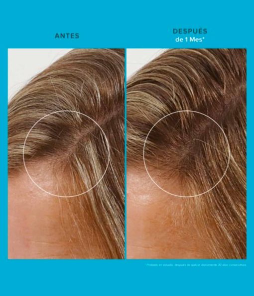 Scalp Care Revitalizing Treatment - Imagen 5